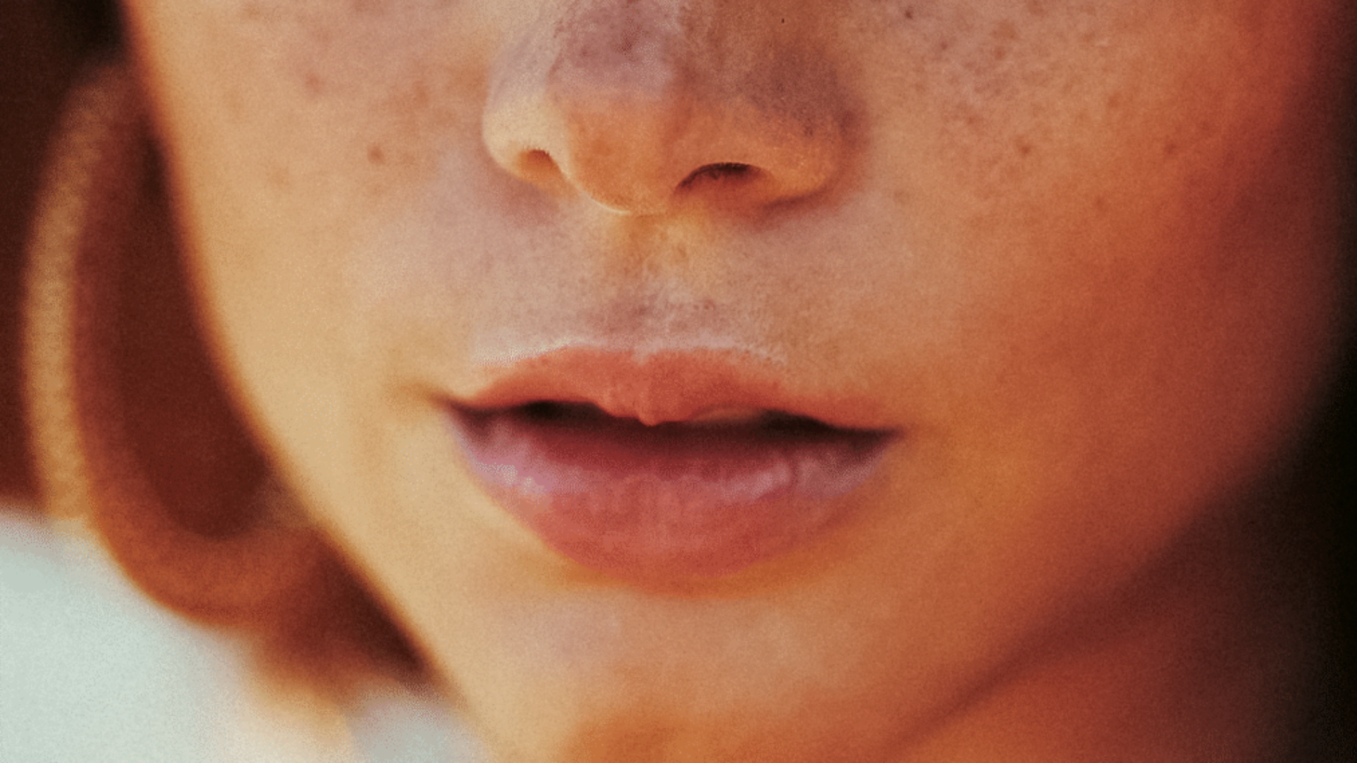 Ácido hialurônico: 7 mitos e verdades sobre seu uso em preenchimentos